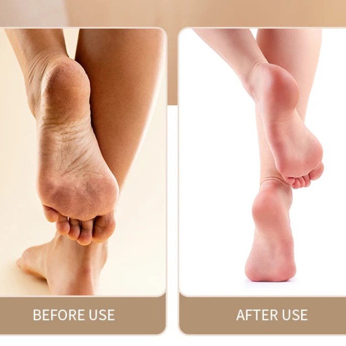 Electric Foot Grinder Professional Callus & Dead Skin Remover